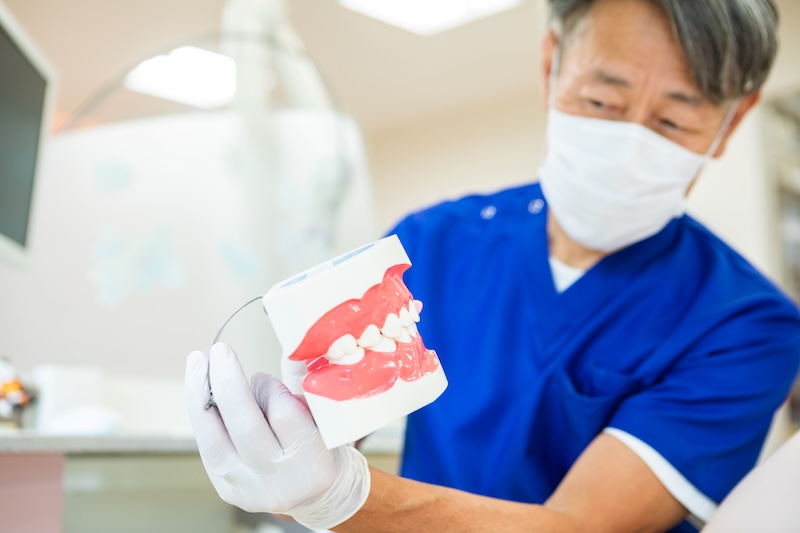 3Mix-MP法による歯髄保存治療