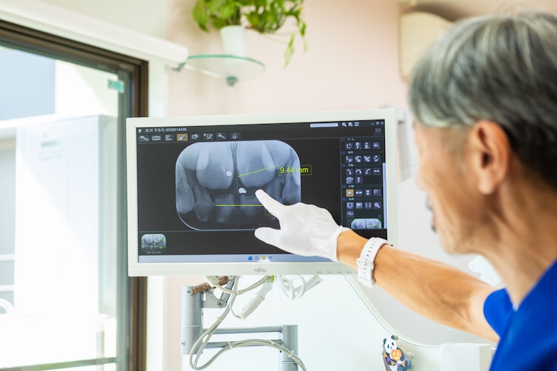 前歯の永久歯が揃った今が診断の適期